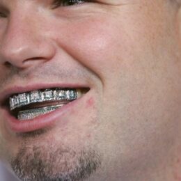 Que sont les grillz ? - La tendance hip-hop qui a le vent en poupe.